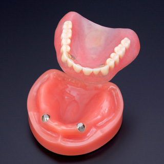 細かいニーズに応える多様な入れ歯